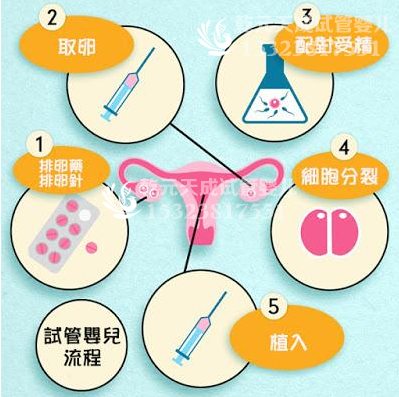 泰国试管婴儿流程