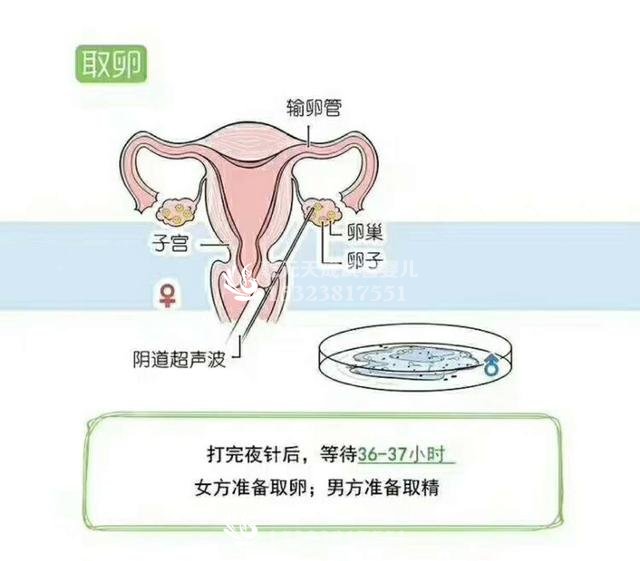 第一次试管婴儿的费包含什么，乾元天成给您详细讲解