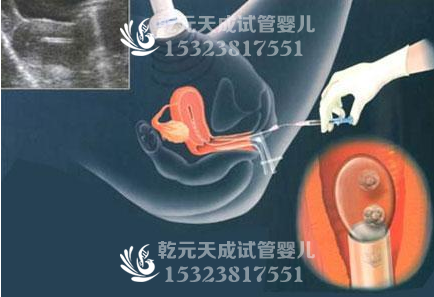 试管婴儿是在医院实验室里长大的吗？