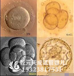 神秘的辅助生殖，试管婴儿受精究竟是怎么做到的？让你看到整个过程