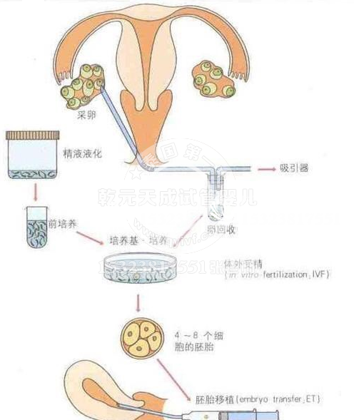 揭秘试管婴儿的孕育过程，妈妈十月怀胎，经历更多的阵痛才把孩子生下