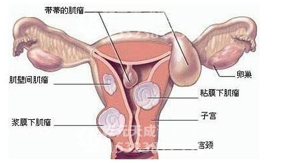 试管婴儿移植后出血，这种情况是移植失败了吗？